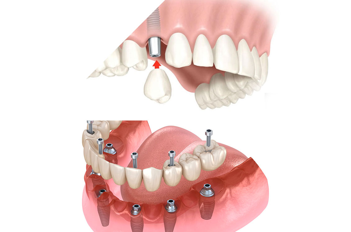 Dentiste Bourg la Reine