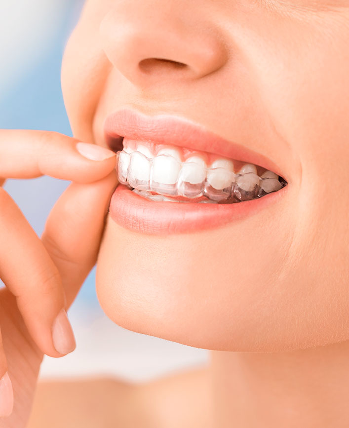 Dentiste Bourg la Reine